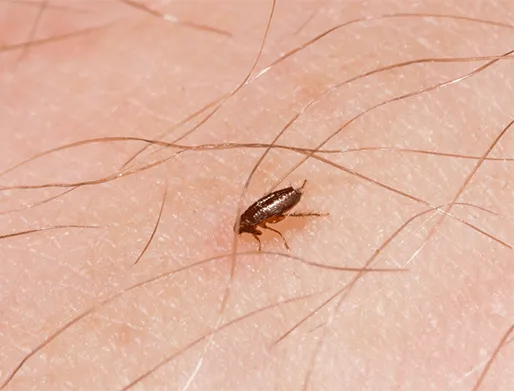 Dedetização de Pulgas em Perdizes